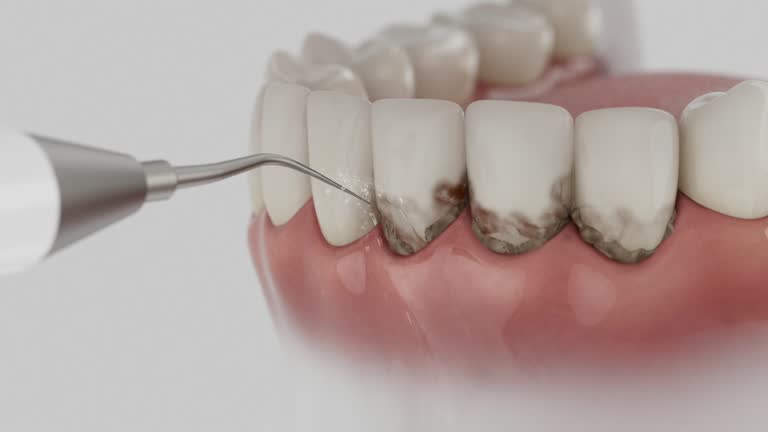 Reliable Dental contractor in Westernport, MD by Dentist Open Now